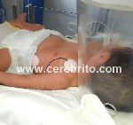 El Neuropediatra y La UCIN